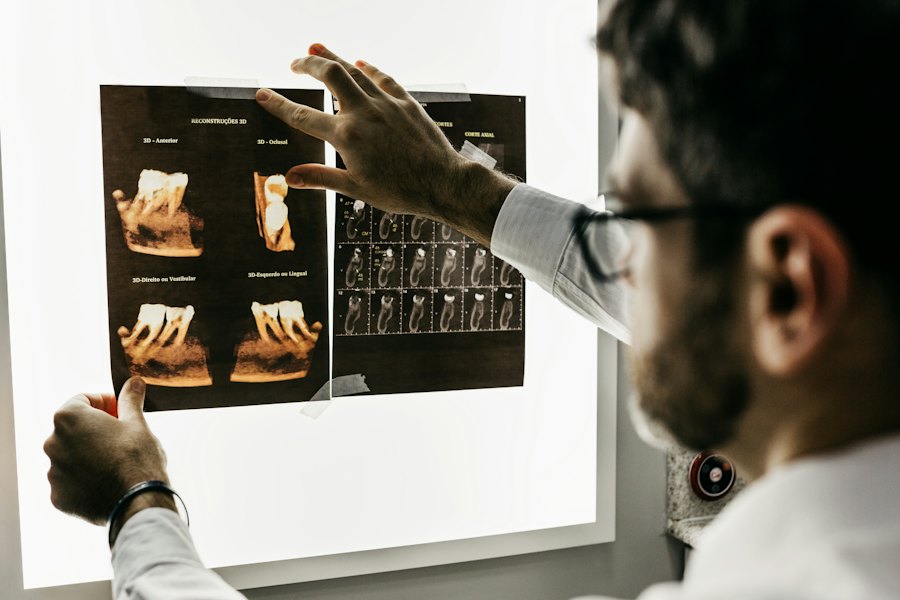 A dentist reviewing dental X-rays on a light box